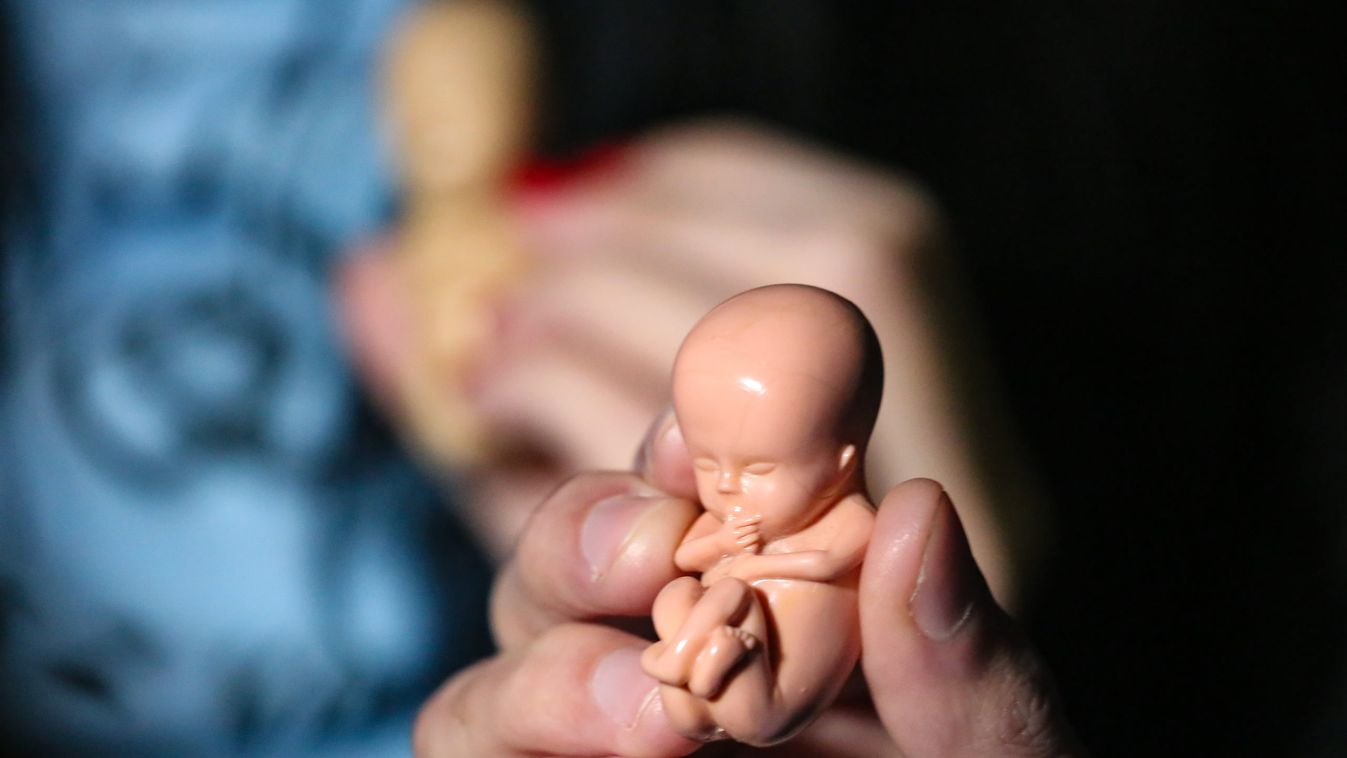 Az abortusz után életben maradt babák életéért folyik a harc