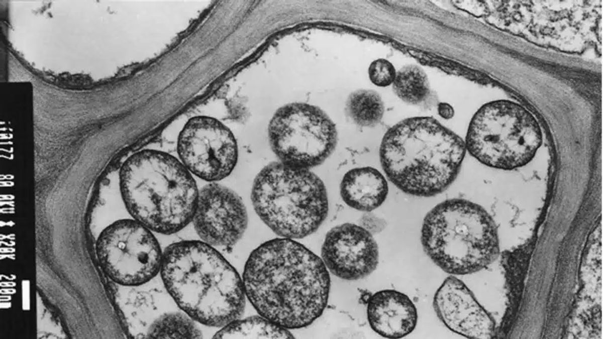Figyelmeztet a hatóság: ezt a betegséget nem szabad félvállról venni